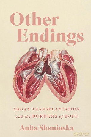 Other Endings: Organ Transplantation and the Burdens of Hope - Anita Slominska [KSIĄŻKA]