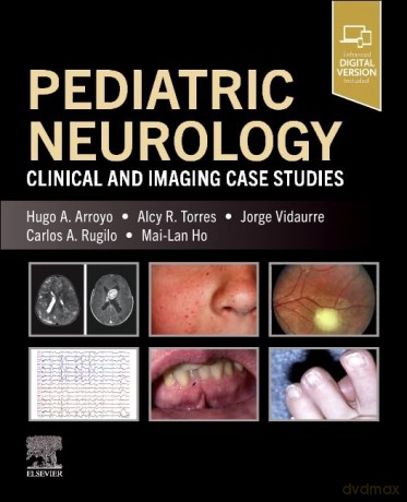 Pediatric Neurology: Clinical and Imaging Case Studies - ugo A. Arroyo [KSIĄŻKA]