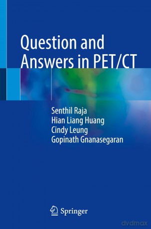 Question and Answers in PET/CT - Raja Senthil [KSIĄŻKA]