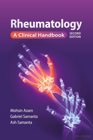 Rheumatology, second edition: A Clinical handbook [KSIĄŻKA]