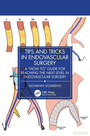 Tips and Tricks in Endovascular Surgery: A "How to" Guide for reaching the next Level in Endovascular Surgery - Solimeno Giovanni [KSIĄŻKA]