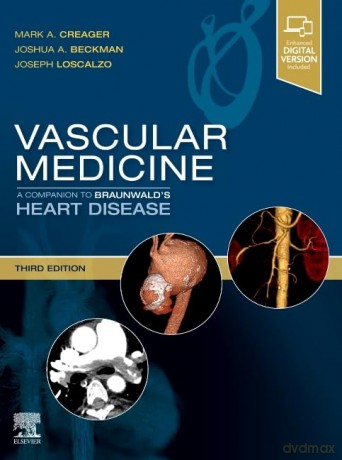 Vascular Medicine: A Companion to Braunwald's Heart Disease: Expert Consult - Online and Print - Mark Creager [KSIĄŻKA]