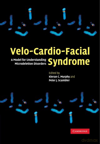 Velo-Cardio-Facial Syndrome: A Model for Understanding Microdeletion Disorders - Kieran C. Murphy [KSIĄŻKA]