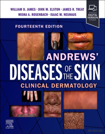 Andrews' Diseases of the Skin - Dirk M. Elston, Misha Rosenbach, William D. James [KSIĄŻKA]