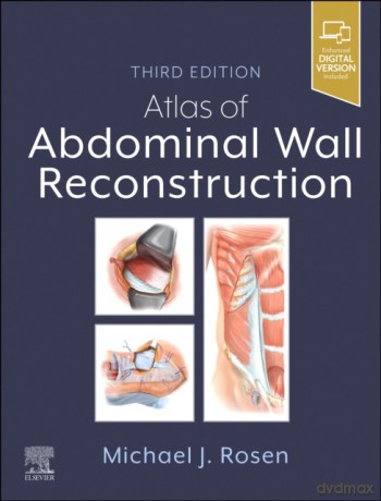 Atlas of Abdominal Wall Reconstruction - Michael J. Rosen [KSIĄŻKA]
