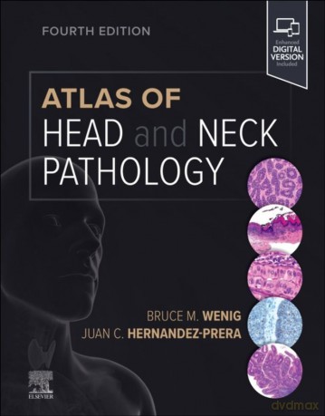 Atlas Of Head And Neck Pathology - Bruce M. Wenig, Juan C. Hernandez-Prera [KSIĄŻKA]