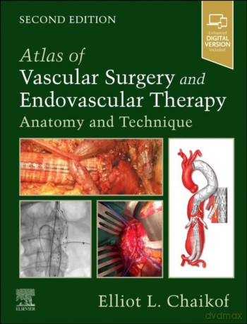Atlas Of Vascular Surgery And Endovascular Therapy - Elliot L. Chaikof [KSIĄŻKA]