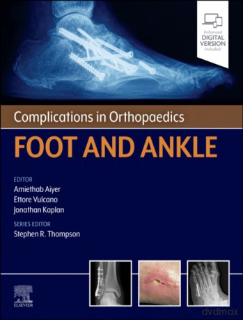 Complications in Orthopaedics. Foot and Ankle - Amiethab Aiyer, Ettore Vulcano, Jonathan Kaplan [KSIĄŻKA]