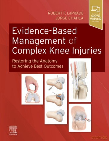 Evidence-Based Management of Complex Knee Injuries - David C. Preston, Barbara E. Shapiro [KSIĄŻKA]