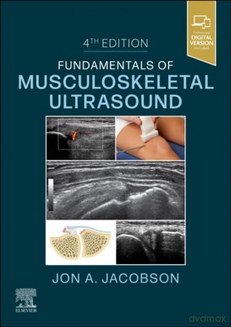 Fundamentals of Musculoskeletal Ultrasound, 4th Edition - Jon A. Jacobson [KSIĄŻKA]