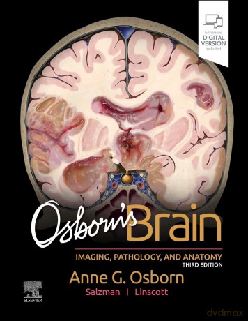 Osborn'S Brain - Anne G. Osborn, Karen L. Salzman, Luke L. Linscott [KSIĄŻKA]