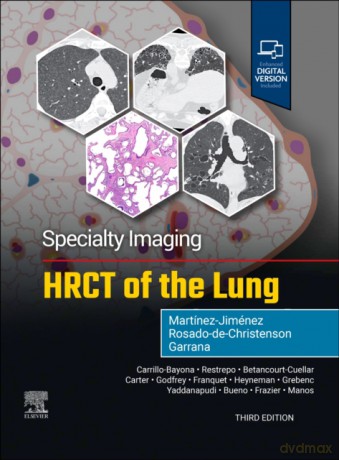 Specialty Imaging: HRCT of the Lung - Melissa L. Rosado-de-Christenson, Santiago Martinez-Jimenez, Sherief Garrana [KSIĄŻKA]