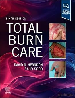 Total Burn Care - David Herndon, Rajiv Sood [KSIĄŻKA]