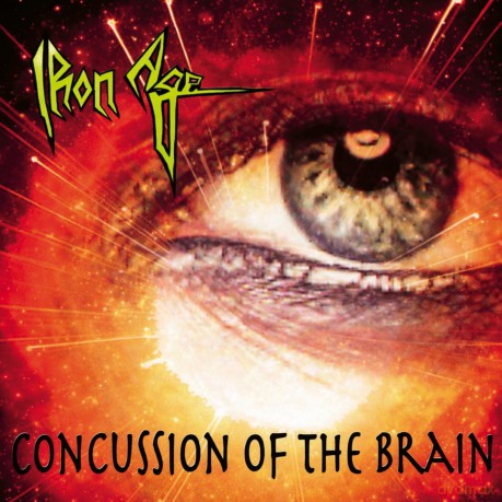Iron Age: Concussion Of The Brain + Bonus [CD]
