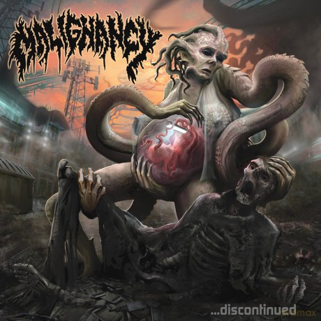 Malignancy: Discontinued [CD]