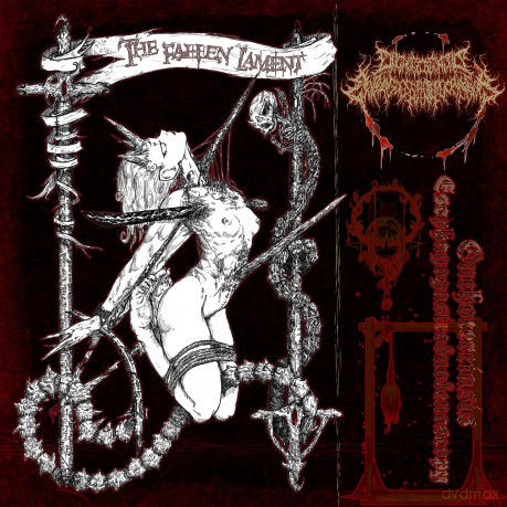 Onchocerciasis Esophagogastroduodenoscopy: Fallen Lament [CD]