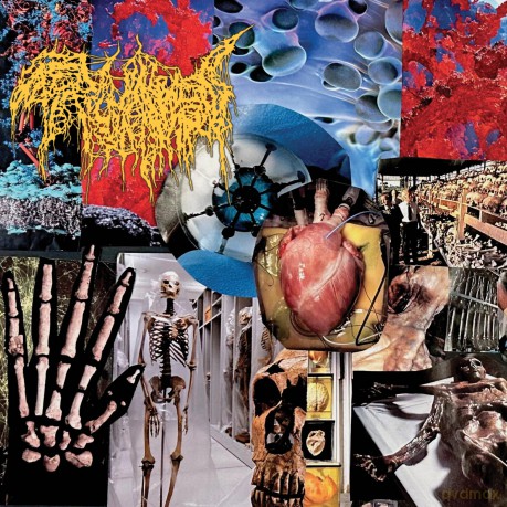 Trichomoniasis: Harvest Of The Killing Fields [CD]