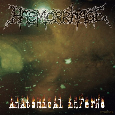 Heaemorrhage: Anatomical Inferno (Lucky Dip Colours/Black) [Winyl]