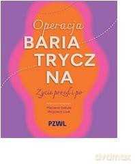Operacja bariatryczna. Życie przed i po - Marzena Sekuła, Wojciech Lisik [KSIĄŻKA]