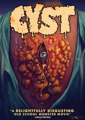 Cyst [DVD]