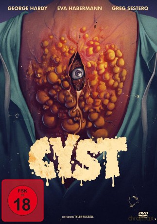 Cyst [DVD]