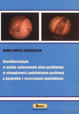 Nasofiberoskopia W Ocenia Zastosowania Płata Gardłowego - Maria Hortis-Dzierzbicka [KSIĄŻKA]