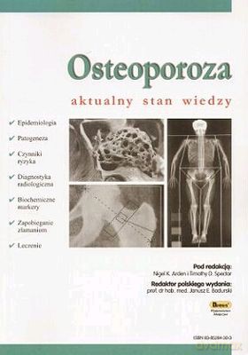 Osteoporoza Aktualny Stan Wiedzy - Praca Zbiorowa, Nigel Arden, Timothy Spector [KSIĄŻKA]