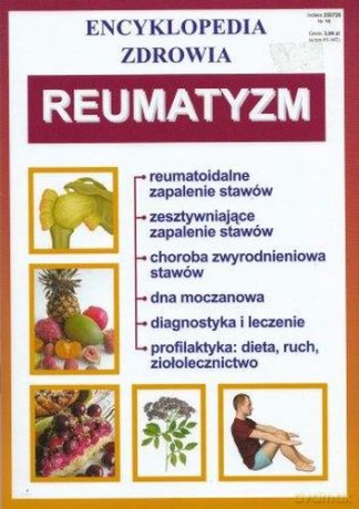 Reumatyzm Encyklopedia Zdrowia [KSIĄŻKA]