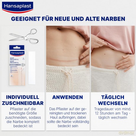 Hansaplast Pflaster NARBEN REDUKTION 272