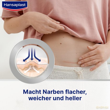 Hansaplast Pflaster NARBEN REDUKTION 272