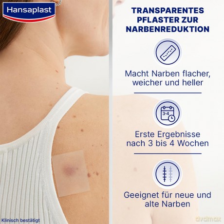 Hansaplast Pflaster NARBEN REDUKTION 272