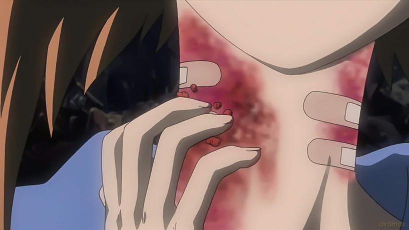 Higurashi Vol.6 [Blu-Ray]