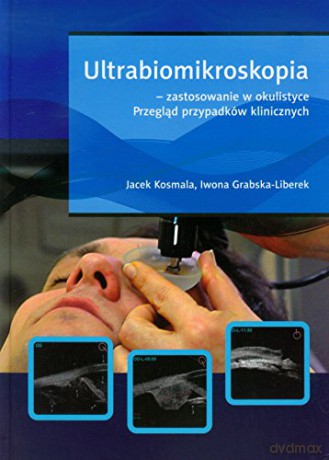 Ultrabiomikroskopia - zastosowanie w okulistyce. Przegląd przypadków klinicznych - Jacek Kosmala, Iwona Grabska-Liberek [KSIĄŻKA]