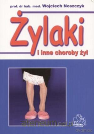 Żylaki i inne choroby żył [KSIĄŻKA]