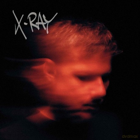 Murdock-X-Ray: Murdock-X-Ray [CD]