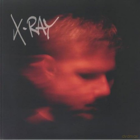 Murdock-X-Ray: Murdock-X-Ray [2xWinyl]