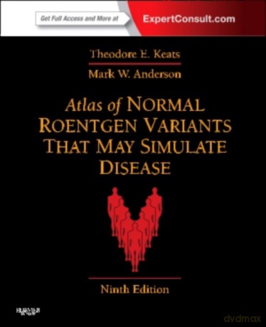 Atlas of Normal Roentgen Variants That May Simulate Disease - Theodore E. Keats, Mark W. Anderson [KSIĄŻKA]