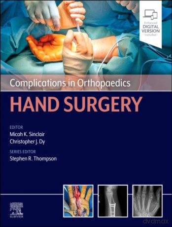 Complications in Orthopaedics. Hand Surgery - Christopher J. Dy, Micah K. Sinclair [KSIĄŻKA]