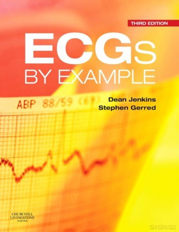 Ecgs By Example - Dean Jenkins, Stephen John Gerred [KSIĄŻKA]