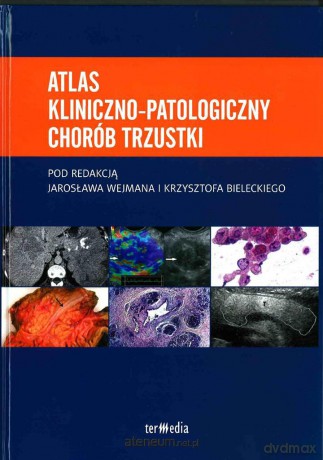 Atlas kliniczno-patologiczny chorób trzustki [KSIĄŻKA]