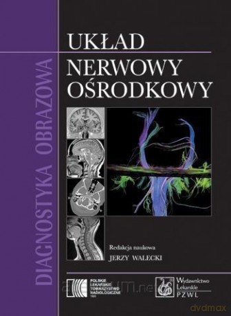 Diagnostyka obrazowa Układ nerwowy ośrodkowy [KSIĄŻKA]