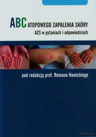 ABC atopowego zapalenia skóry [KSIĄŻKA]