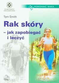 Rak skóry. Jak zapobiegać i leczyć [KSIĄŻKA]