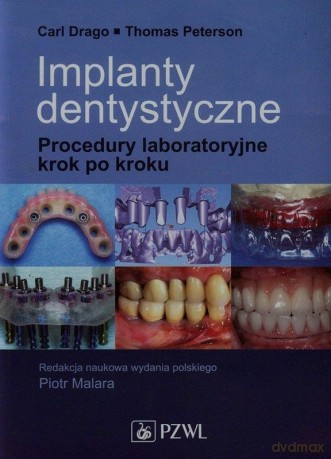 Implanty dentystyczne. Procedury laboratoryjne [KSIĄŻKA]