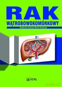 Rak wątrobowokomórkowy (twarda) [KSIĄŻKA]