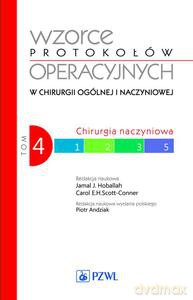 Wzorce protokołów operacyjnych w chirurgii ogólnej i naczyniowej (Tom 4) - Jamal Hoballah [KSIĄŻKA]