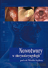 Nowotwory w otorynolaryngologii [KSIĄŻKA]