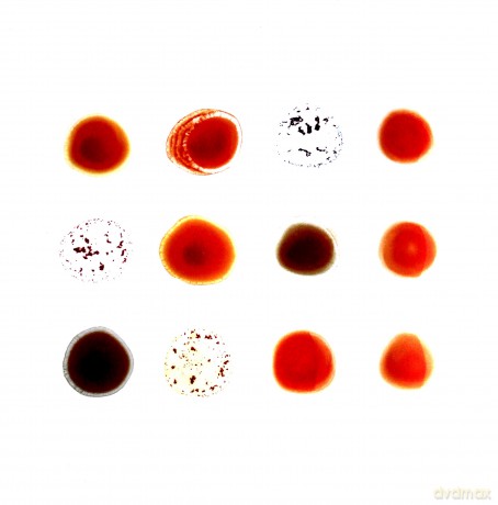 Peter Gabriel: Scratch My Back/And [2xWinyl]