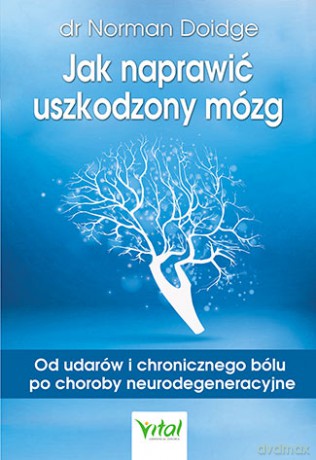 Jak naprawić uszkodzony mózg. Od udarów i chronicznego bólu po choroby neurodegeneracyjne - Norman Doidge [KSIĄŻKA]