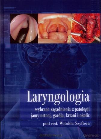 Laryngologia wybrane zagadnienia [KSIĄŻKA]